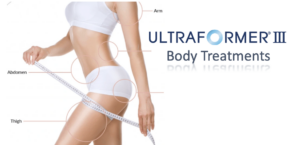 Ultraformer Body treatments Cheshire Lasers 